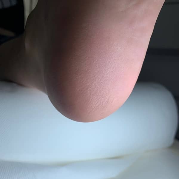 stopa po usłudze pedicure z kwasami callus